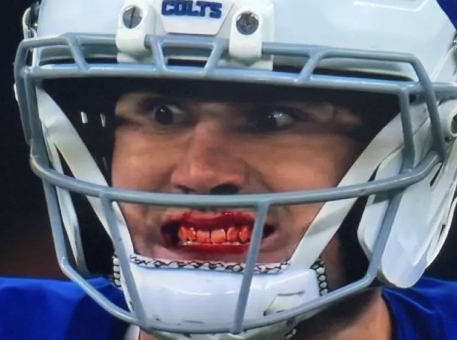 NFL Player Smiling with Bloody Mouth - Quarterback Anthony Richardson - Indianapolis Colts